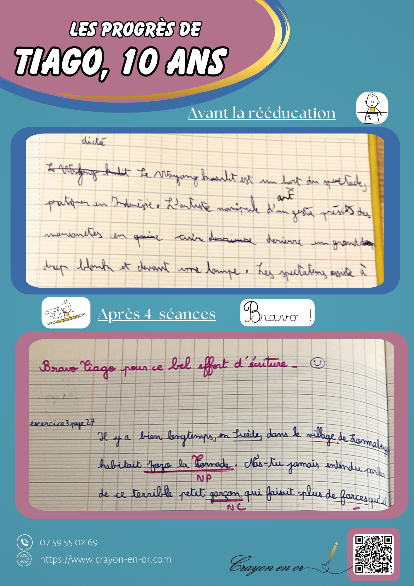 Les progrès de Tiago, 10 ans, après 4 séances